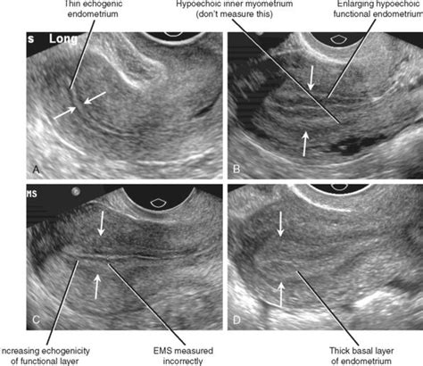 453 best images about Medicine/Radiology/Pathology on Pinterest ...