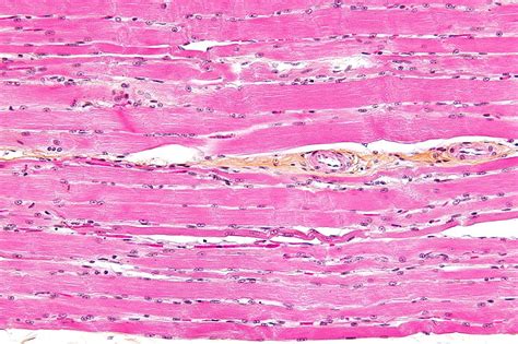 Difference Between Striated Non Striated and Cardiac Muscles | Compare ...