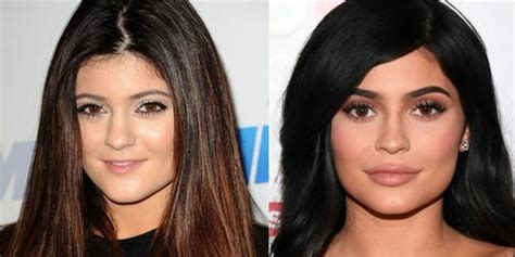 Plastic surgery before and after - 9 celebrities on what it's really like