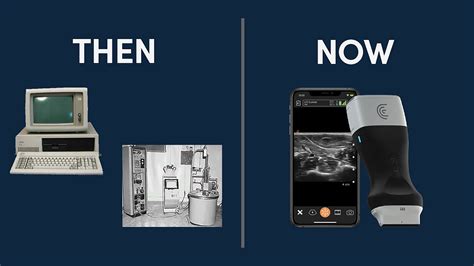 A Brief History of Medical Ultrasound | Clarius