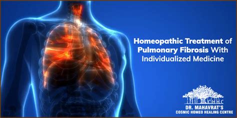 Homeopathic treatment of Pulmonary Fibrosis With Individualized Medicine