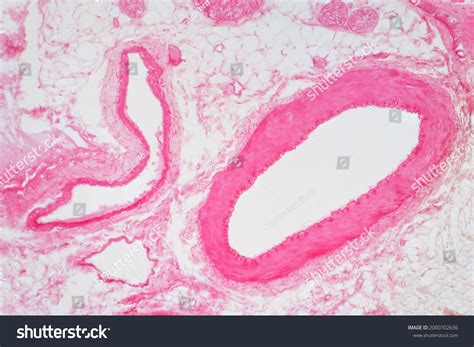 Vein Histology: Over 608 Royalty-Free Licensable Stock Photos | Shutterstock