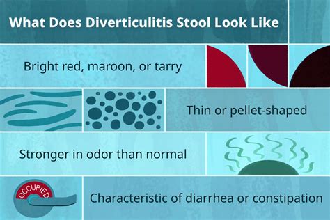 Diverticulitis Stool Pictures: Changes in Bowel Movements