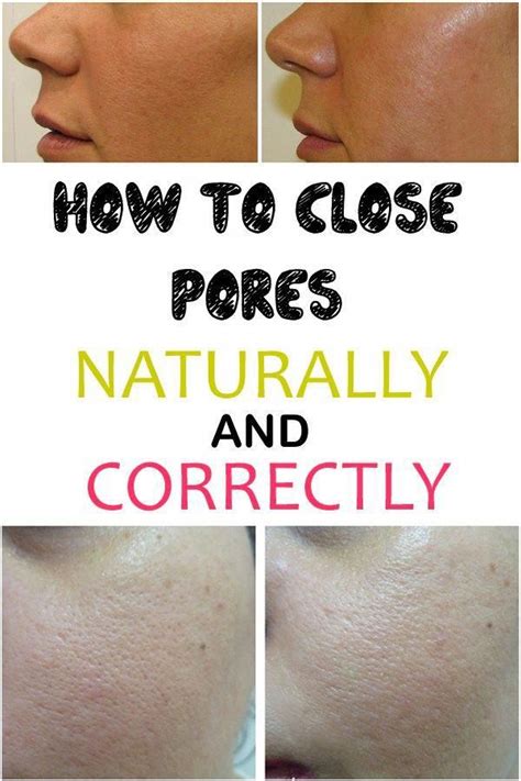 How to close pores naturally and correctly #getridofporestheeasyway | How to close pores, Face ...