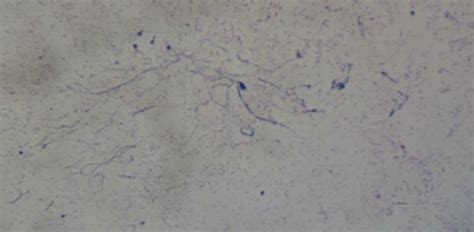 Appearance of Fusobacterium necrophorum in an impression smear under a ...