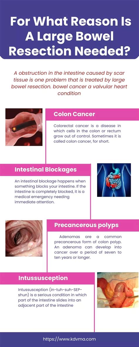 PPT - For What Reason Is A Large Bowel Resection Needed PowerPoint Presentation - ID:11685835