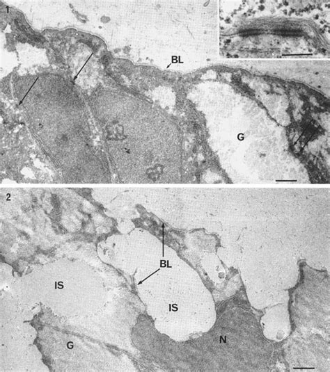 Human notochord at the beginning of the 6th embryonic week. Closely ...