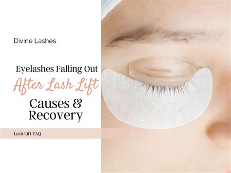 Eyelashes Falling Out After a Lash Lift – Causes & Recovery