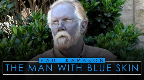 Paul Karason | The Man With Blue Skin - YouTube