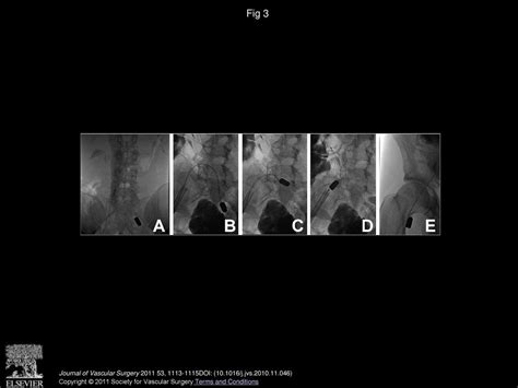 Mary Elizabeth Schroeder, MD, Howard I. Pryor, MD, Albert K - ppt download