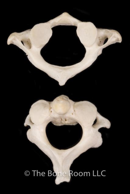 Human Atlas & Axis Vertebrae Set