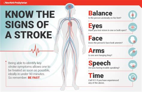 First Aid for Stroke – Dr. Kashi | Stroke symptoms, Stroke recovery, Symptoms