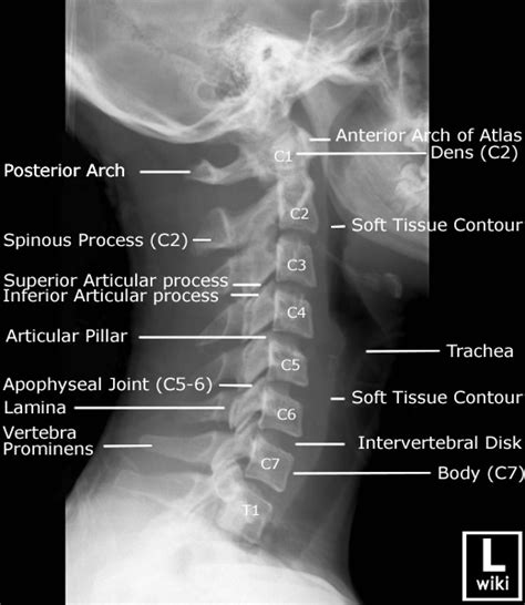 Radiographic Anatomy Of The Skeleton Cervical Spine Cervical Spines ...