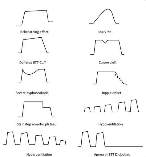 Different capnography patterns. | Download Scientific Diagram