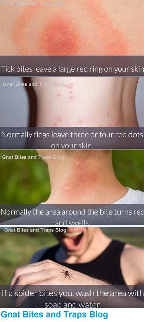 What Bit Me? How to Identify Common Bug Bites? with photos ~ Best Homemade Gnat Traps and Gnat ...