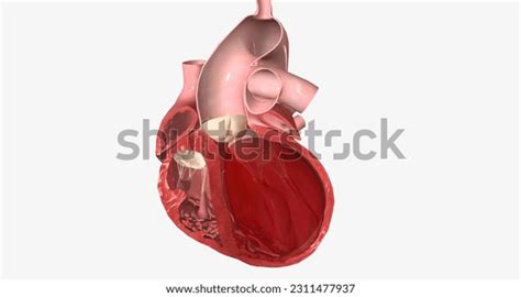 1+ Hundred Cardiac Apex Royalty-Free Images, Stock Photos & Pictures | Shutterstock