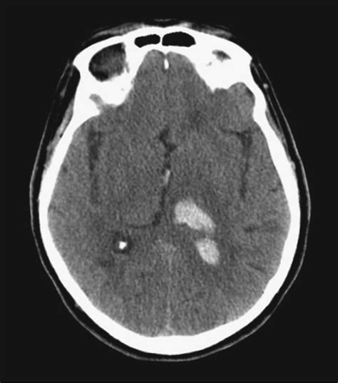 Neurology Summary | Basicmedical Key