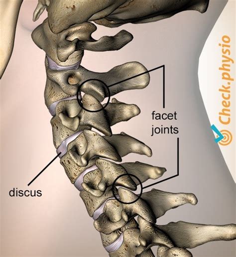 Cervical posture syndrome | Physio Check