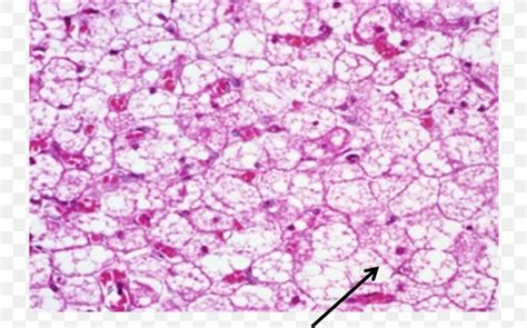 Brown Adipose Tissue Histology Connective Tissue, PNG, 953x595px, Adipose Tissue, Adipocyte ...