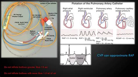 Hemodynamic Monitoring Part 1 - YouTube | Icu nursing, Nursing study, Nurse