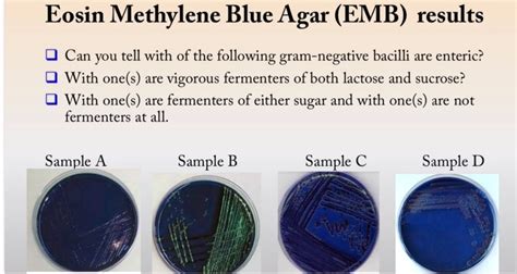 SOLVED: Eosin Methylene Blue Agar (EMB) results Can you tell with of the following gram-negative ...