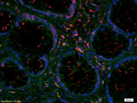 Von Willebrand Factor Antibody (BS-10048R)