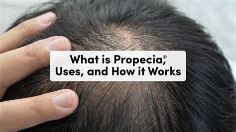 Propecia: Uses, Side Effects and Dosage | Good Health by Hims