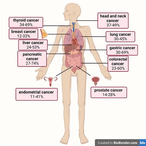 Prevalence of cancer cachexia in different cancer types. Based on data ...