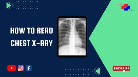 How To Read Chest X-Ray || Chest X-Ray Kaise Dekhe || Activeplusphysio || #physiotherapy #xray ...