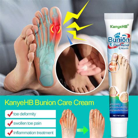 niaoxsd KanyeHB Bunion Pain Relief Cream | Lazada PH