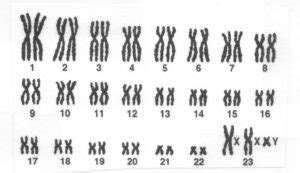 Karyotype and Idiogram : A way to provide preliminary idea about Genome : Plantlet