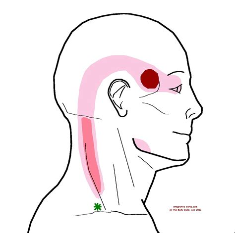 Headache At Your Temple with stiff neck | Integrative Works