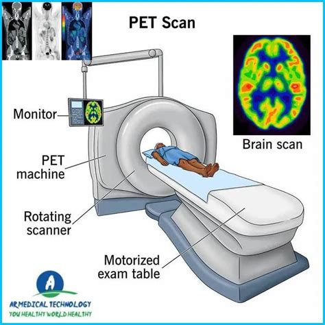 Understanding The Difference Between Mri And Ct Atlan - vrogue.co