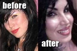 Kat Von D Plastic Surgery Before and After Botox and Tattoos - Star Plastic Surgery Before and After