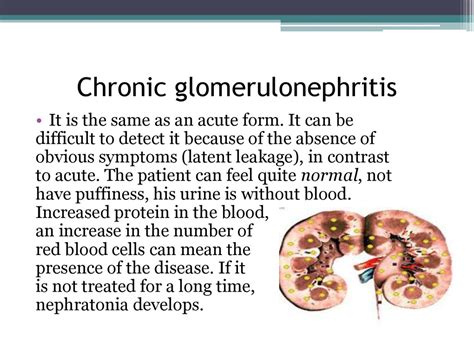 Pathophysiology Of Glomerulonephritis