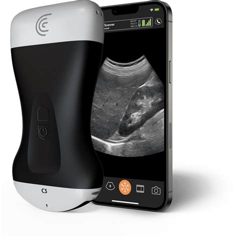 Handheld Ultrasound Machine | Clarius