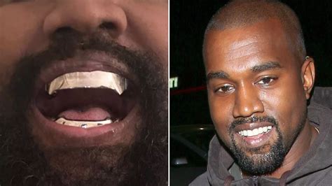 Kanye West’s new $850,000 experimental titanium teeth are 'fixed and ...