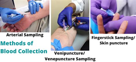 Blood Collection Methods; Arterial , Venipuncture, Fingerstick Sampling