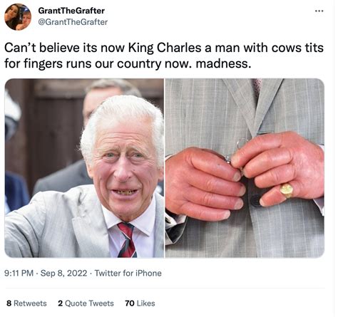 Cow Tits | King Charles Sausage Fingers | Know Your Meme