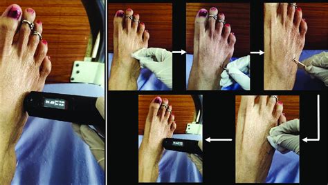 Measuring vasodilation-induced change in surface temperature using the... | Download Scientific ...