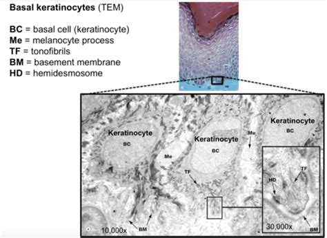 Keratinocytes Histology