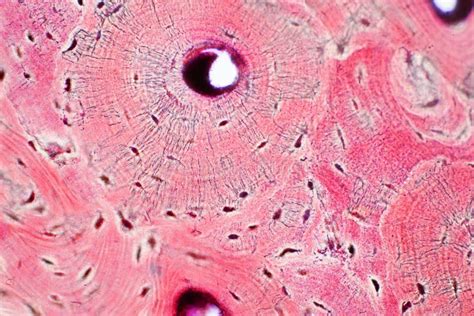 Histology of Human Compact Bone Tissue Under Microscope View for Stock ...