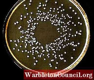 Lactobacillus delbrueckii: characteristics, morphology - science - 2024