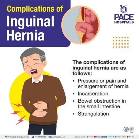 Hernia Symptoms, Types, Causes, Complications, Prevention, 53% OFF