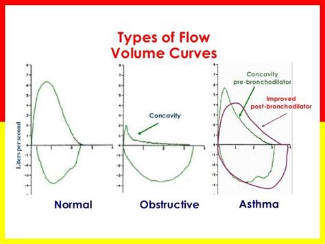 Basic, Curves, Chart