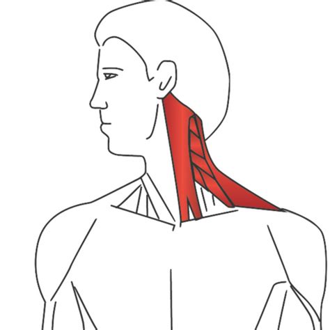 Sternocleidomastoid Stretch