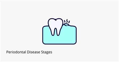 Periodontal Disease Stages - Share Dental Care