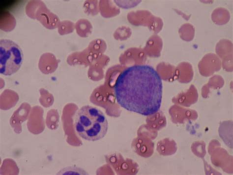 Difference Between Promyelocyte and Myelocyte | Compare the Difference Between Similar Terms