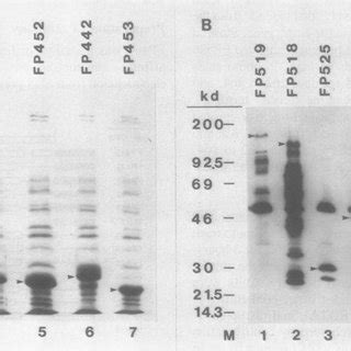 Analysis of fusion proteins present in bacterial extracts. The fusion... | Download Scientific ...