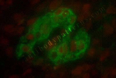 Islet Cell Antibodies (ICA) - Biomarker.org Novel Biomarker Discovery